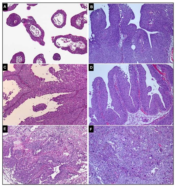 J Cancer Image