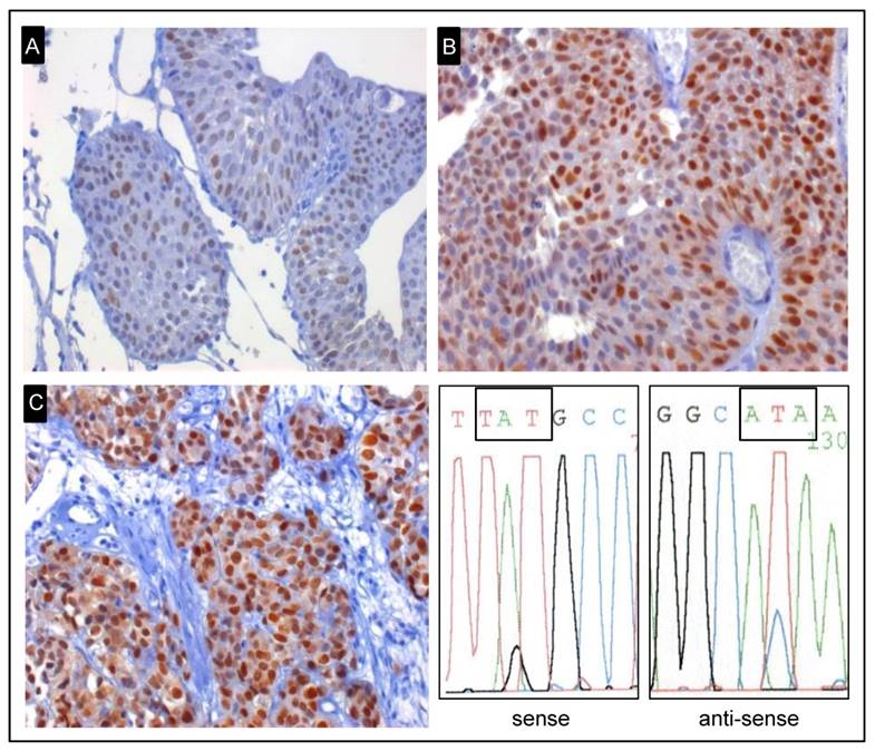 J Cancer Image