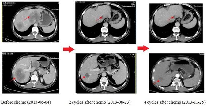 J Cancer Image