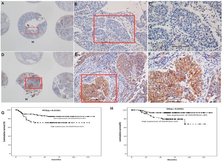 J Cancer Image