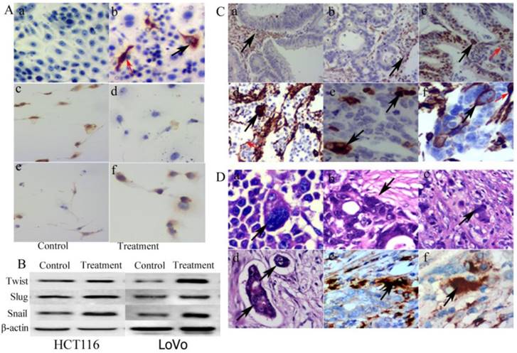 J Cancer Image