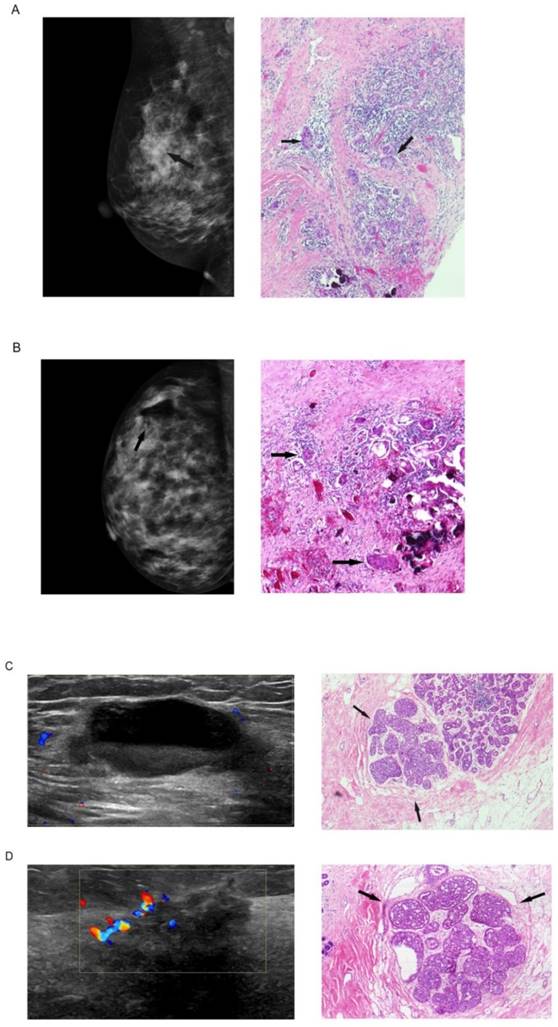 J Cancer Image