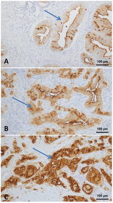 J Cancer Image