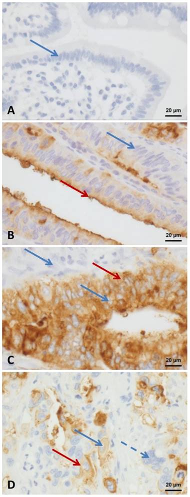 J Cancer Image