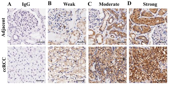 J Cancer Image