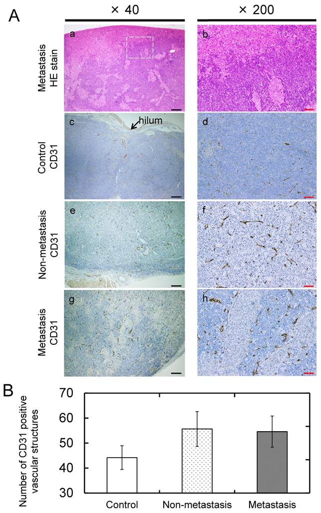 J Cancer Image