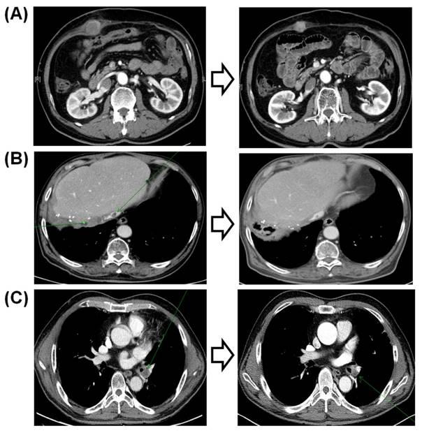 J Cancer Image