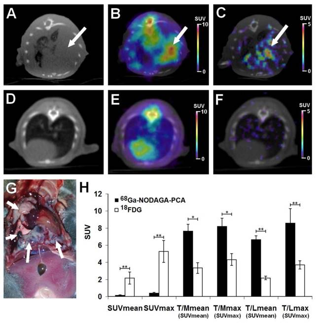 J Cancer Image