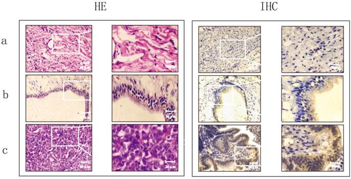 J Cancer Image