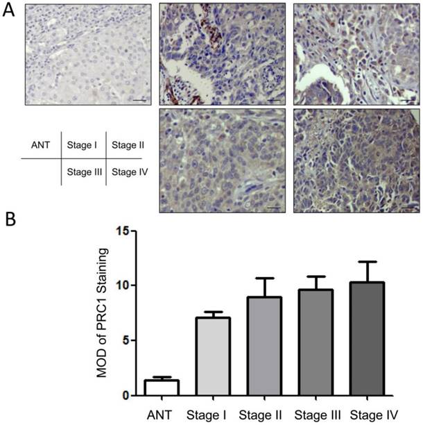 J Cancer Image