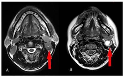 J Cancer Image