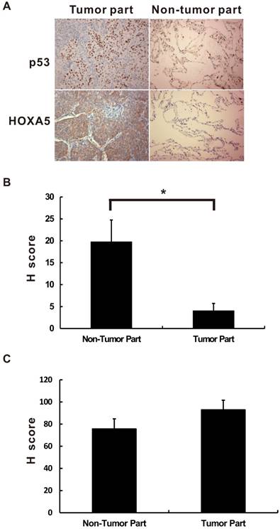 J Cancer Image