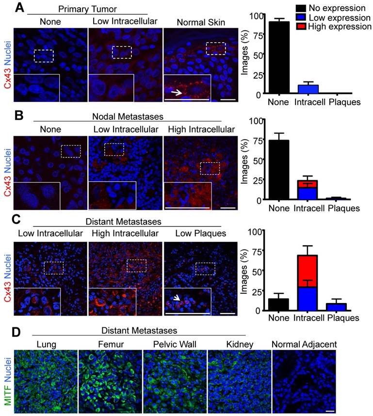 J Cancer Image