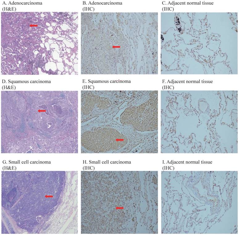 J Cancer Image