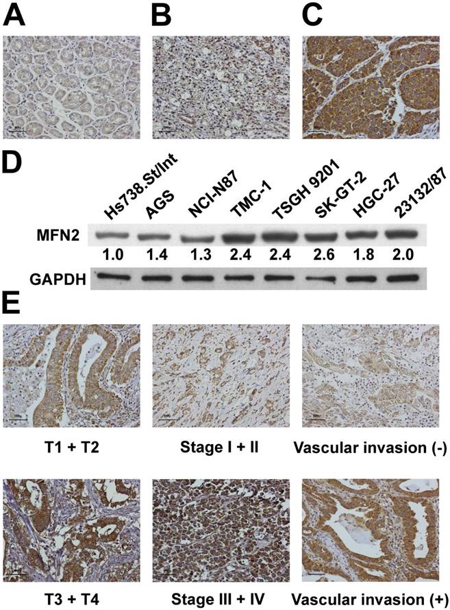 J Cancer Image