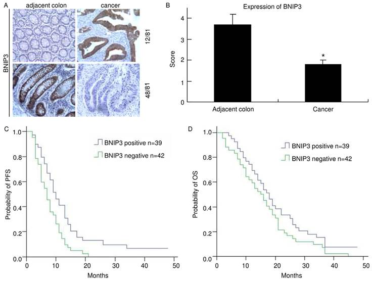 J Cancer Image