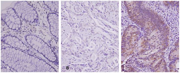 J Cancer Image