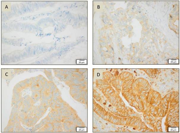 J Cancer Image