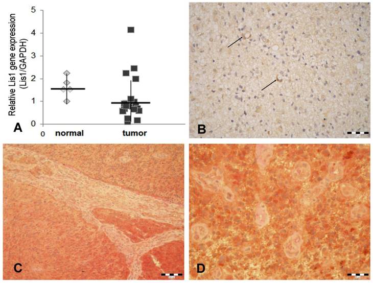 J Cancer Image