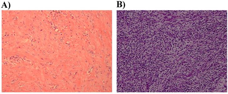 J Cancer Image