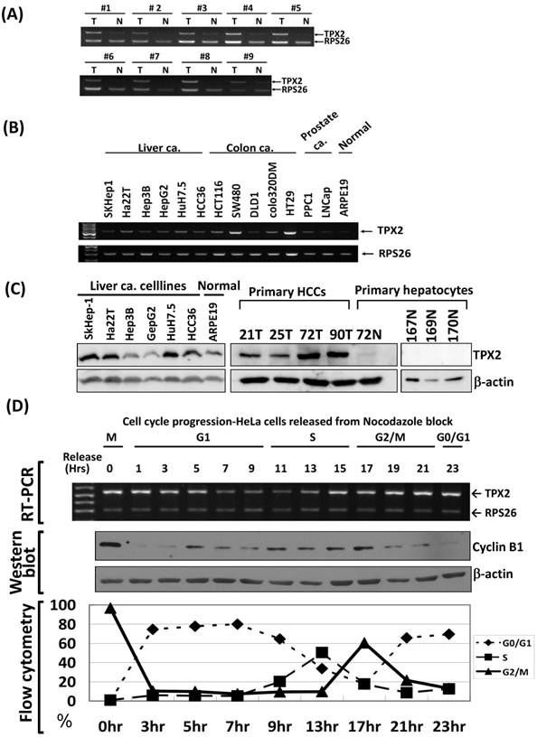 J Cancer Image