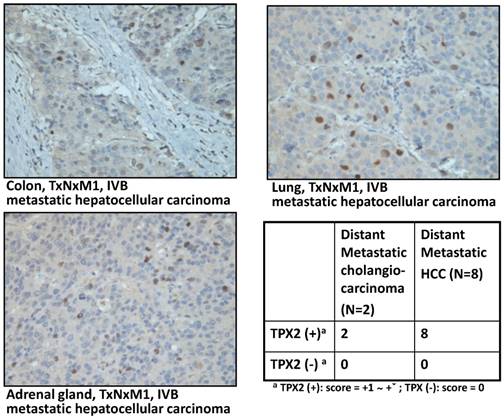 J Cancer Image