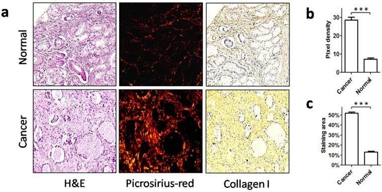 J Cancer Image