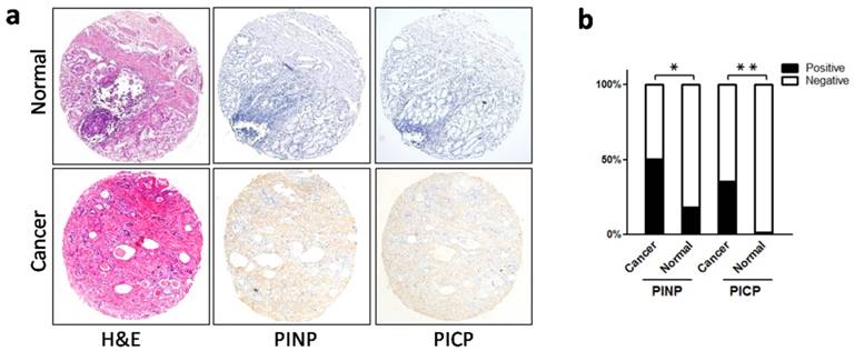 J Cancer Image