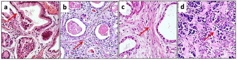 J Cancer Image