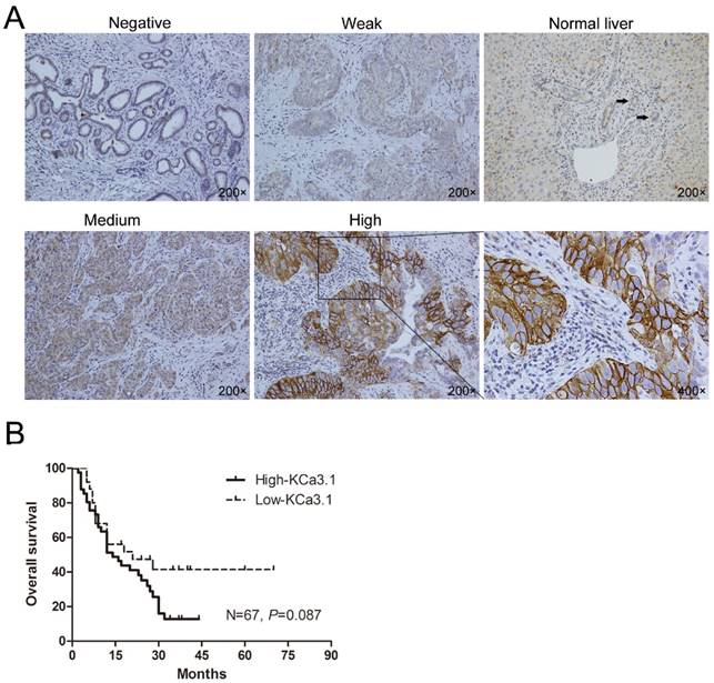 J Cancer Image