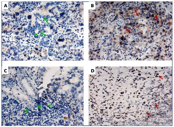 J Cancer Image