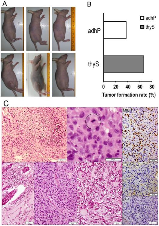 J Cancer Image