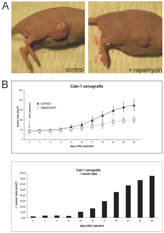 J Cancer Image