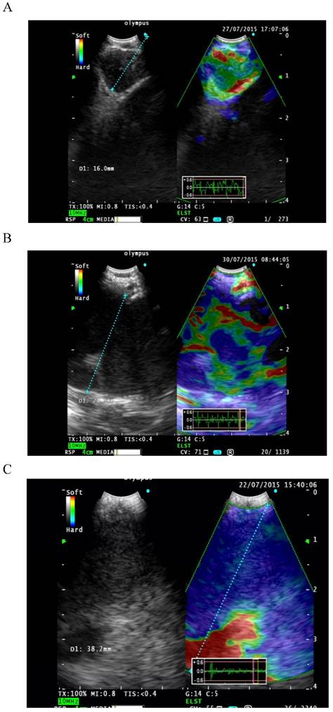 J Cancer Image