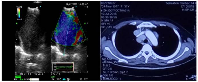 J Cancer Image