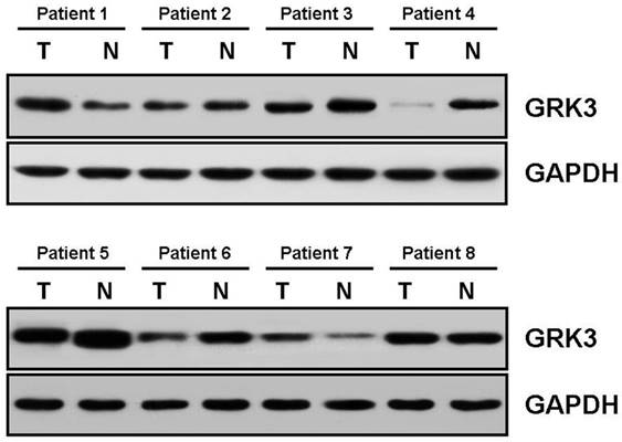 J Cancer Image