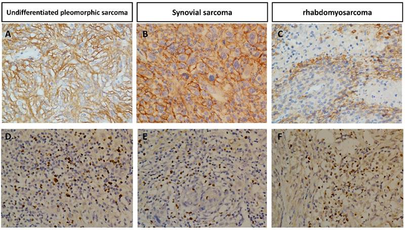 J Cancer Image