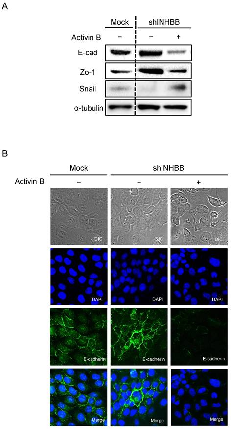 J Cancer Image