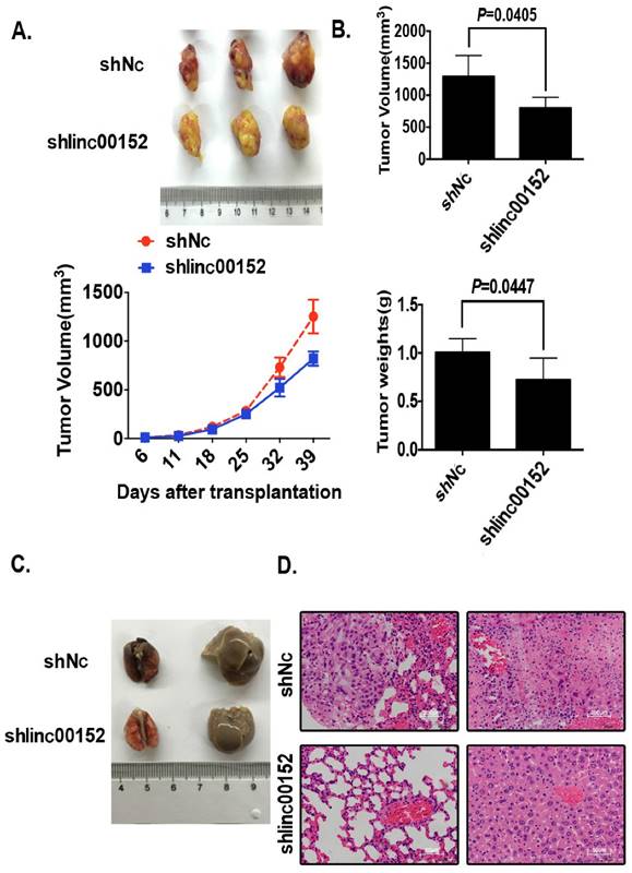 J Cancer Image