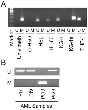 J Cancer Image