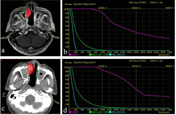 J Cancer Image