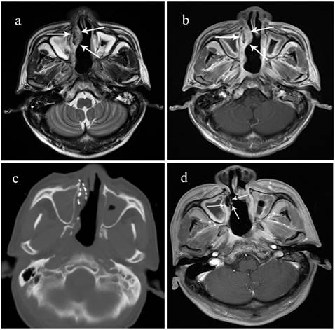 J Cancer Image