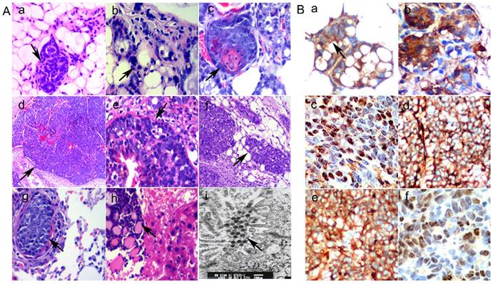 J Cancer Image