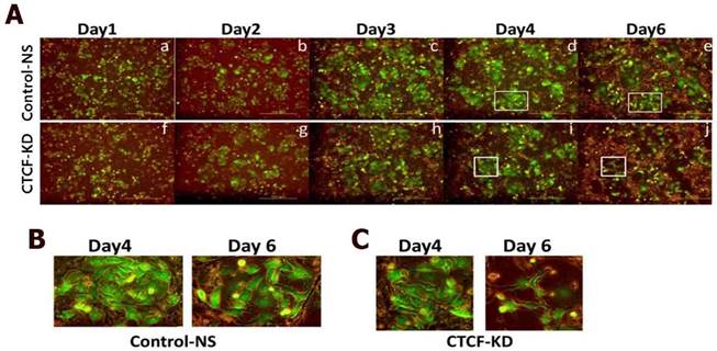 J Cancer Image