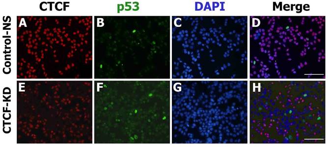 J Cancer Image