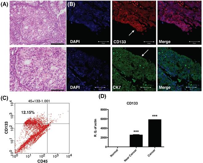 J Cancer Image