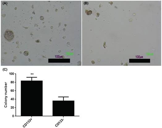 J Cancer Image