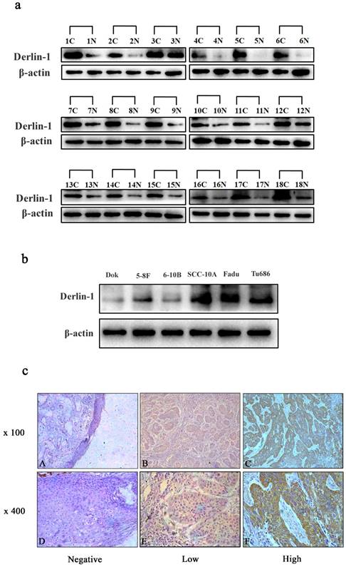 J Cancer Image