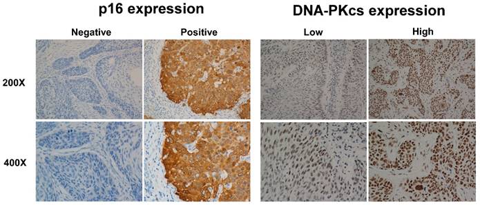 J Cancer Image