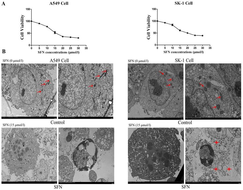 J Cancer Image